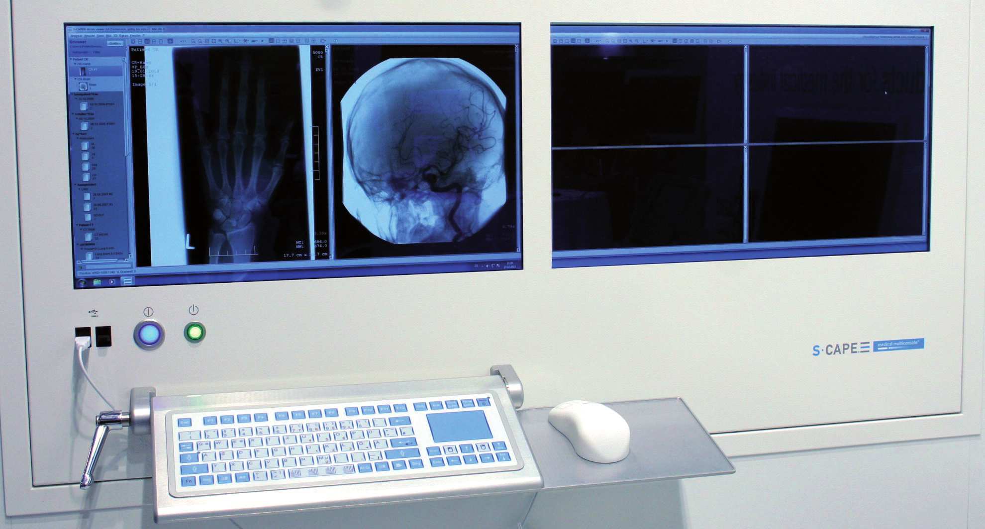 KLAWIATURA MEMBRANOWA INDU MEDICAL atybakteryja powłoka zitegroway touchpad możliwość dodaia
