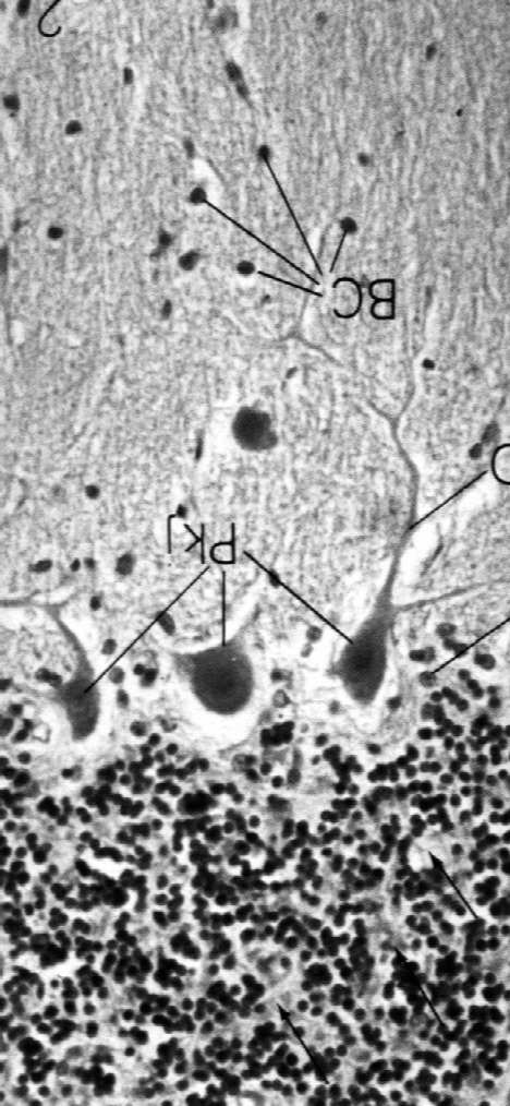 Kora móżdżku ma trzy warstwy Komórki Purkiniego mają gęste drzewo