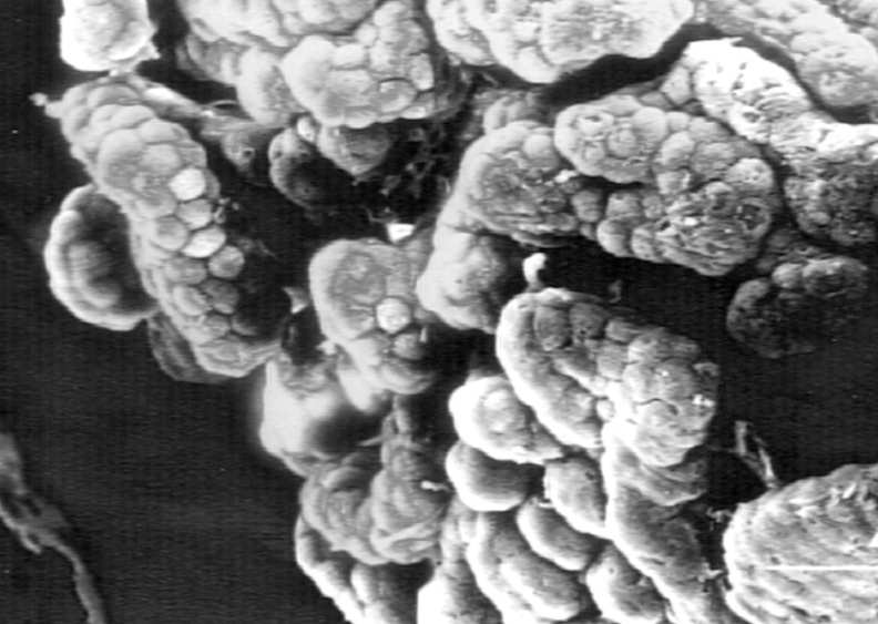 Od tkanki nerwowej oddziela ja warstwa wypustek astrocytów (glejowa błona graniczna) Opona twarda Opona pajęcza (beleczki)