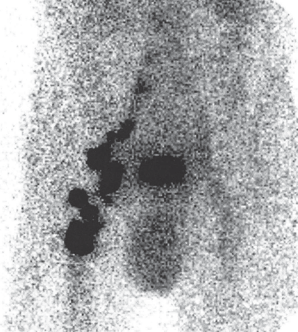 Acta Angiol., 2002, Vol. 8, No. 2 Figure 3.