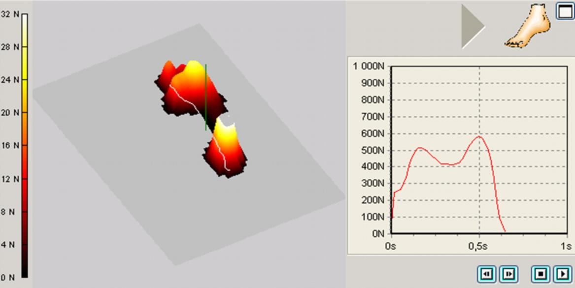 W badaniach brana pod uwagę była jedynie składowa pionowa siły reakcji podłoża, ponieważ jej wektor w najlepszy sposób odzwierciedla ewentualne odchylenia od normy w chodzie fizjologicznym.