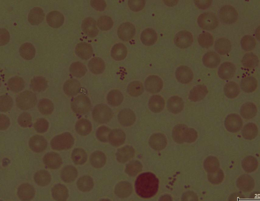 Grupa II dla preparatu B: Dwieście dwadzieścia jeden (49,2%) ośrodków otrzymało rozmaz dodatniej kropli krwi zawierający ziarenkowce Gram-ujemne Neisseria meningitidis PM-250 (zdjęcie