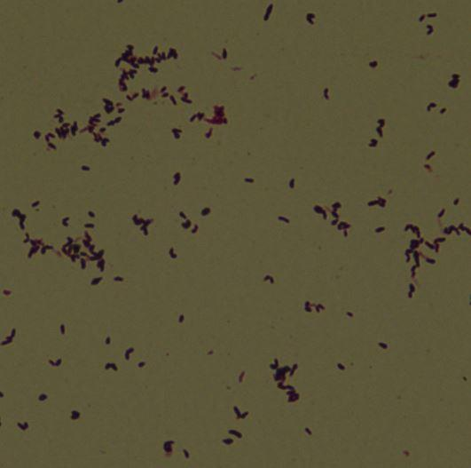 Do przygotowania wykorzystano zawiesiny w soli fizjologicznej trzech szczepów kontrolnych: Corynebacterium diphteriae PM-251, Bacillus subtilis PM-252 i Capnocytophaga canimorsus PM-253.