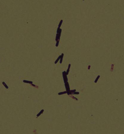 Laboratoria nie miały większych problemów z oceną tego preparatu.