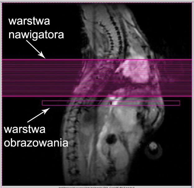 Na czas obrazowania MR, zwierzęta poddano anestezji wziewnej 2% izofluranem w mieszaninie powietrza i tlenu.