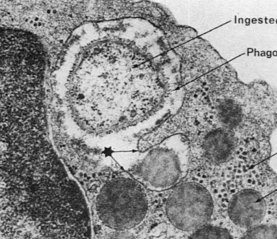 Pod wpływem czynników chemotaktycznych leukocyt zbliża się do ściany naczynia (marginacja); leukocyt i komórki śródbłonka ulegają aktywacji. 2.