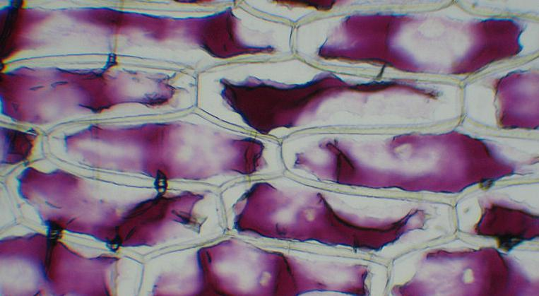 Plazmoliza Plazmoliza - zjawisko odstawania cytoplazmy od ściany komórkowej. Plazmolizę można zaobserwować w komórkach roślinnych po umieszczeniu ich w roztworze hipertonicznym.