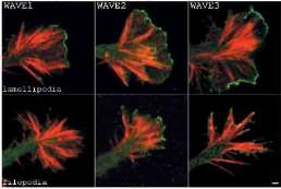 Filopodia Lamellipodia by Ken Balazovich Filopodia J Cell Sci. 2003 Jan 15;116(Pt 2):239-46.