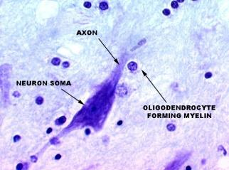 Oligodendrocyty mniejsze niż astrocyty, z