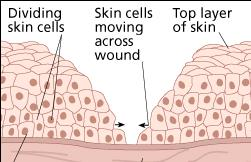 Regeneracja uszkodzenia Dzielące się komórki warstwy rozrodczej naskórka Przesuwanie się komórek w