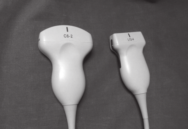 is best suited for ultrasound guided insertion of lines. Catheterization procedure sterility must be ensured. Anestezjologia i Ratownictwo 2016; 10: 219-226.