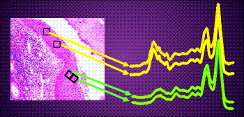 Hyperspectral Sensing Pathology Spectral signatures provide fingerprints of