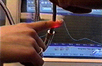Monitoring Tissue Physiology Use of hyperspectral imaging to monitor tissue