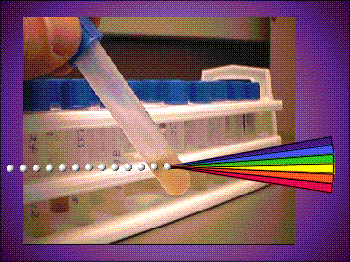Clinical Chemistry Hyperspectral Sensing The quantitative reagentless