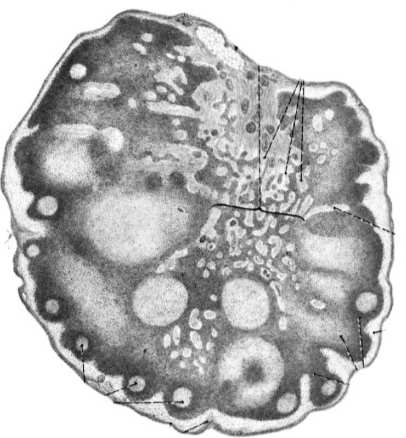 drogi oddechowe plazmocyt apoptoza Formy tkanki limfoidalnej: limf.