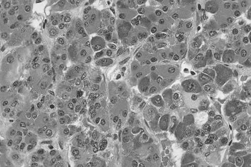 Dwa szlaki podwzgórze-przysadka: małe komórki neurosekretoryczne (jąder drobnokomórkowych) duże komórki produkują czynniki (hormony) neurosekretoryczne regulujące aktywność wydzielniczą komórek