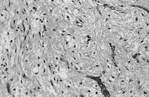 komórek neurosekretorycznych pituicyty