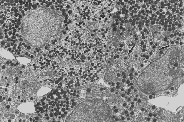 komórek część pośrednia: chromofoby i komórki