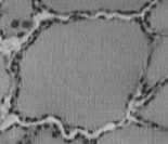 włosowate delikatna tkanka łączna endocytoza magazynowanie tyreoglobuliny koloid