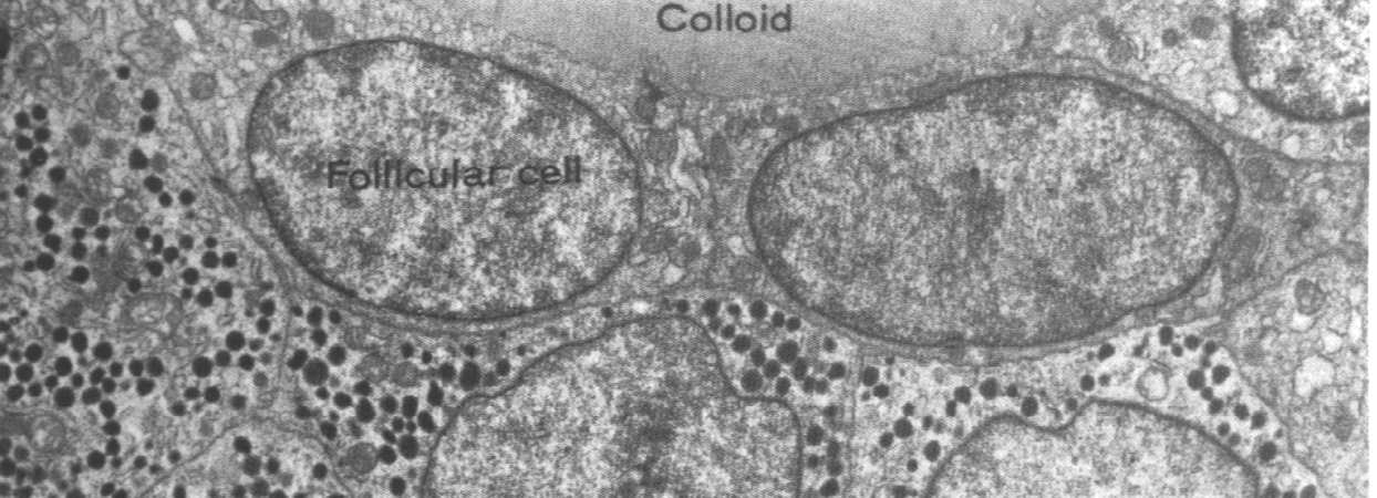 komórkach pęcherzykowych: endocytoza jodowanej tyreoglobuliny, jej trawienie w