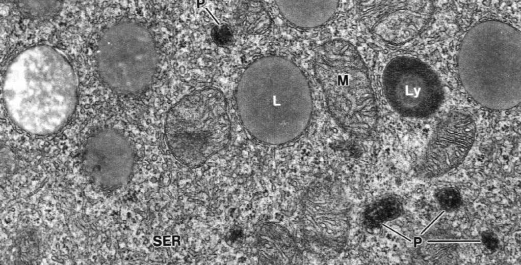kłębkowata Małe komórki z nielicznymi kroplami lipidowymi mineralokortykoidy (np.