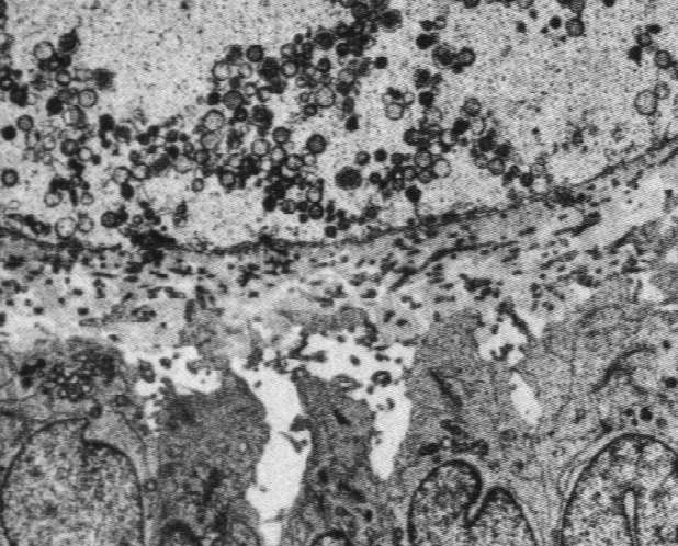 wewnętrzna (theca interna) liczne naczynia włosowate, zmodyfikowane komórki zrębu (fibroblasty) przekształcone w komórki steroidogenne Komórki theca interna produkują androgeny, które są