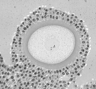 Komórki warstwy ziarnistej wydzielają proteoglikany i kwas hialuronowy, które przyciągają wodę rozproszenie komórek warstwy ziarnistej, wzrost ciśnienia wewnątrz pęcherzyka 6.