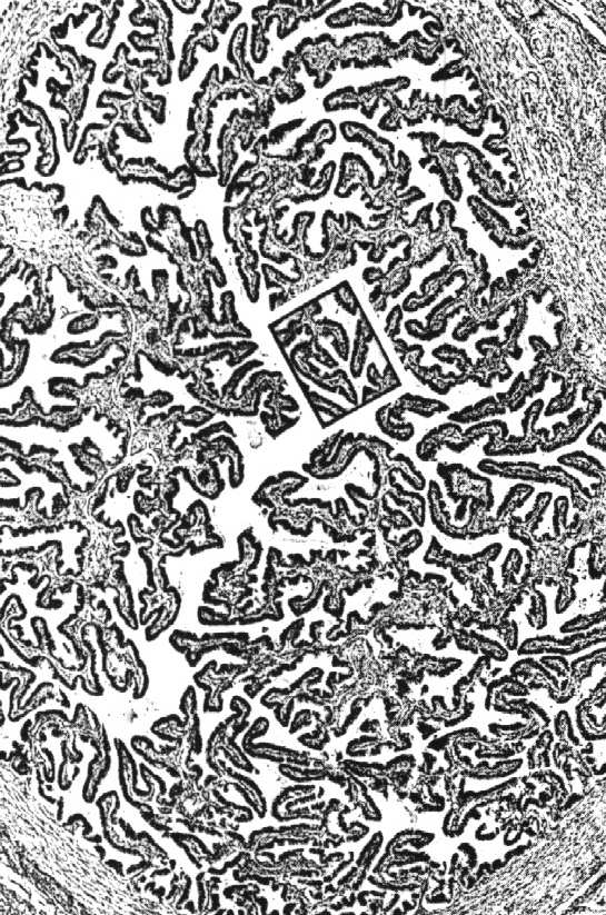 ziarnisto-luteinowe komórki osłonkowo-luteinowe komórki śródmiąższowe komórki wnękowe (rzadkie,