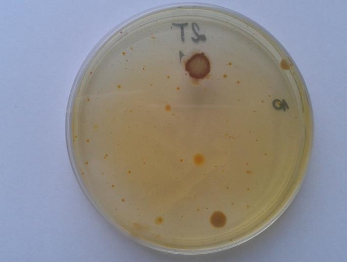 Thermophilic bacteria Wygląd płytek z koloniami bakterii mezofilnych (rys.