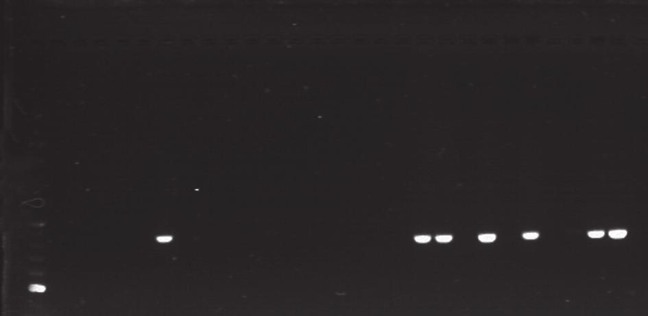 Significant variation was found in the intensity of sharp eyespot in respective years of growing barley. 3.