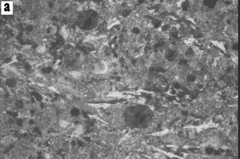 Microstructure of nodular cast iron: a) initial state, b) after DSC investigation Różnica spowodowana jest prawdopodobnie większym udziałem dendrytów austenitu, składnika żeliwa o mniejszej wartości