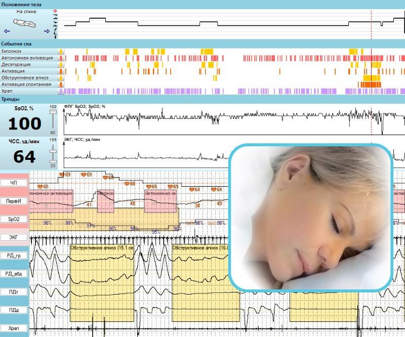 y przeznaczone do diagnostyki różnych rodzajów zaburzeń snu.