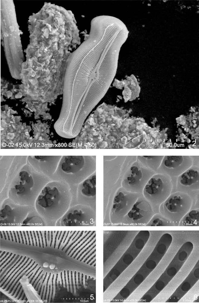 174 Fragm. Flor. Geobot. Polonica 17(1), 2010 Ryc. 2 6. Didymosphenia geminata (Lyngb.) M.