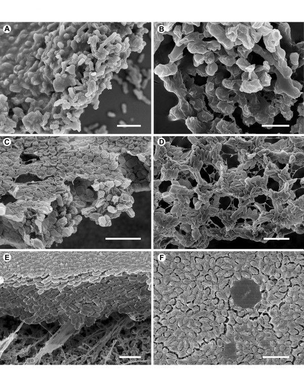 Dr inż. Joanna Biernasiak Tematyka badawcza: Biofilmy w przemyśle cukrowniczym W ramach tego tematu dokonano wstępnego przeglądu literatury na temat biofilmów w przemyśle spożywczym.