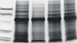 Analiza Western blot 119 kda 97,4 kda 1 2 3 4 5 2 3