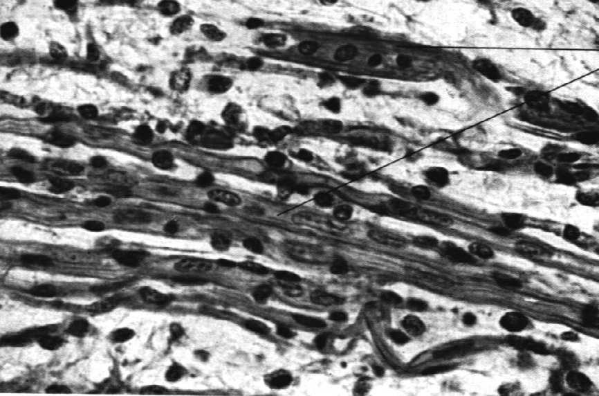 mięsień pęczek mięśniowy blaszka podstawna cytoplazma jądro włókno