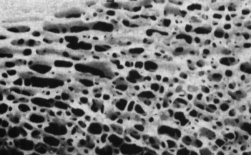 osteoklasty (stymulacja różnicowania) produkują osteoprotegerynę