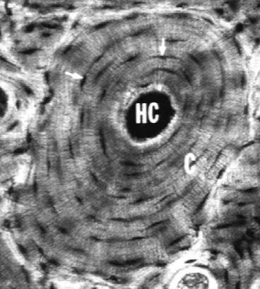 (systemy Haversa). Zwarty układ równoległych osteonów tworzy kość.