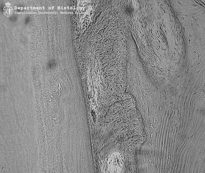 sploty naczyniowe foramen caecum brodawki okolone cement kość zębodołu