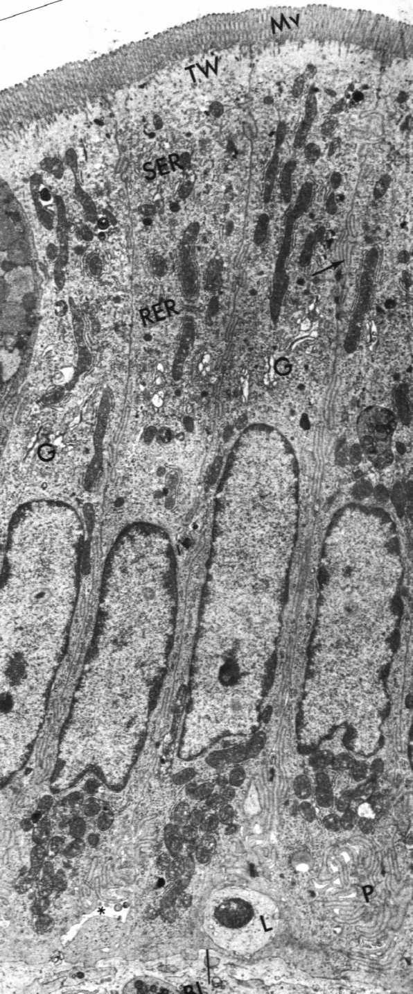 M Enterocyty wysokie, walcowate