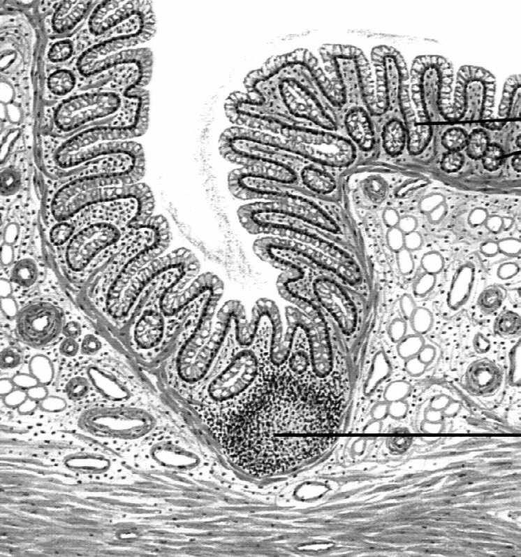 limfoidalna cewy pokarmowej Wyrostek robaczkowy ma budowę