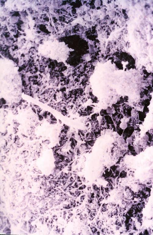 Choroby grzybicze Czynnikami etiologicznymi tej grupy chorób są grzyby wodne należące do typu Oomycetes rodzajów Saprolegnia (S. parasitica, S.