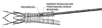 7 Pod ciągłą kontrolą fluoroskopową wsuwać system wprowadzania odnogi biodrowej do układu naczyniowego do momentu zrównania proksymalnych markerów radiologicznych odnogi biodrowej z najbardziej