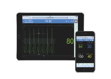 MView łączy możliwości wieloparametrowego monitora pacjenta serii Infinity z integracją danych w