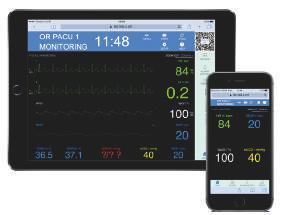 Ekran Infinity serii S Inteligentny ekran klasy medycznej pokazuje wszystkie zmierzone paramenty
