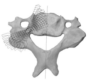 Ocena biomechaniczna zastosowania kotwic w stabilizacji