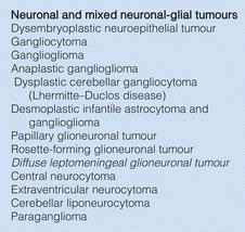 Medulloblastoma: