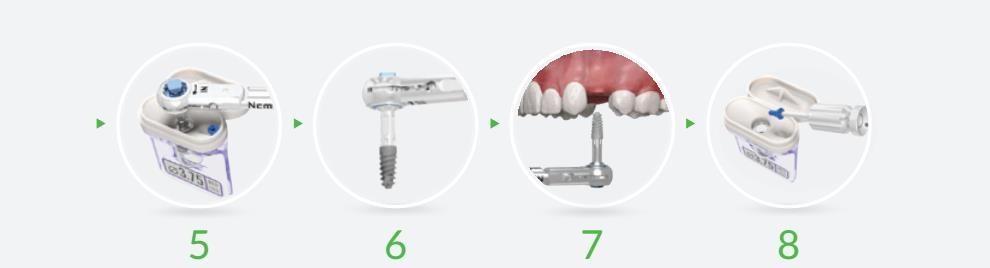 Wewnętrzny Hex IH Klucze Trzpień sześciokątny na całej długości Znaczniki grubości tkanki miękkiej Rowki do oznaczania poziomu implantu Funkcja trwałej przyczepności Pin wiodący do centrowania i