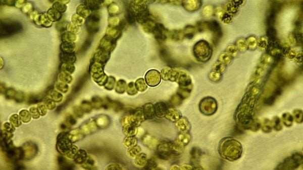 2. Glony zaliczane do bakterii. Sinice (cyjanobakterie) Cechy budowy: Jednokomórkowe.
