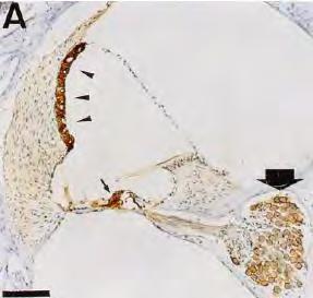 Ekspresja Kir w ślimaku Immunohistochemiczna lokalizacja Kir4.